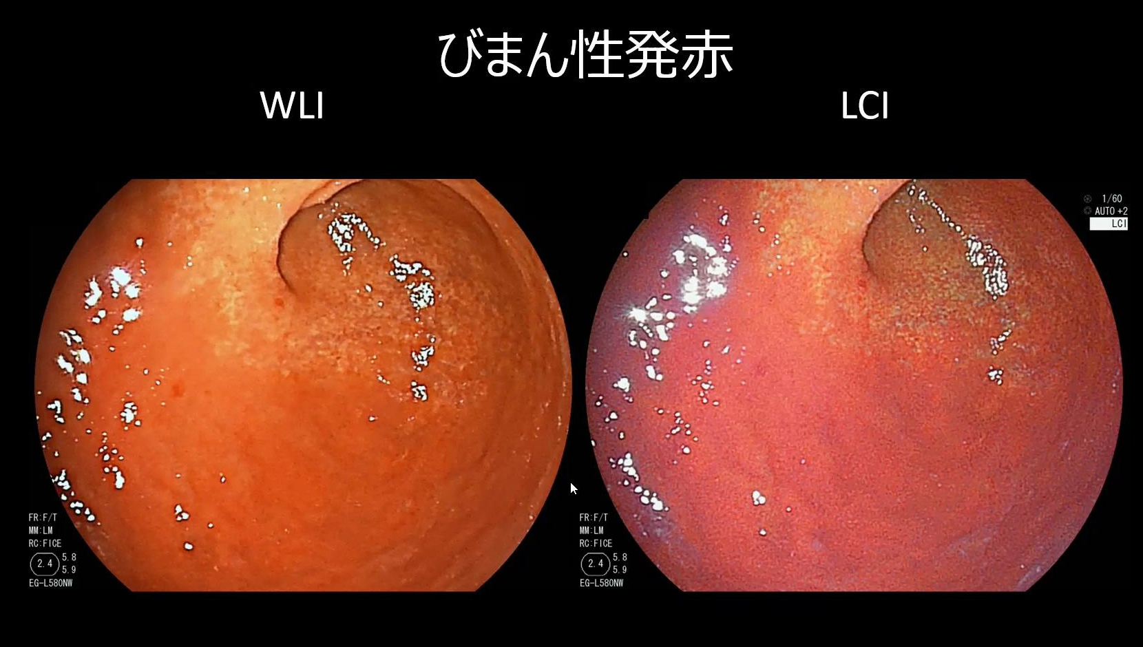 上右.jpg