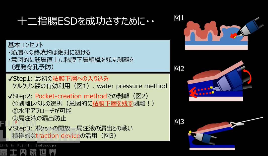 推文图片2.png